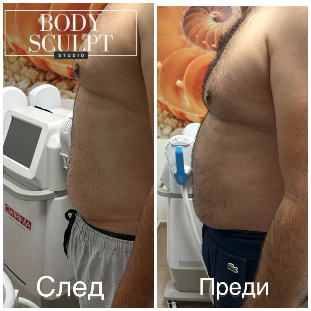 Преди и след резултати